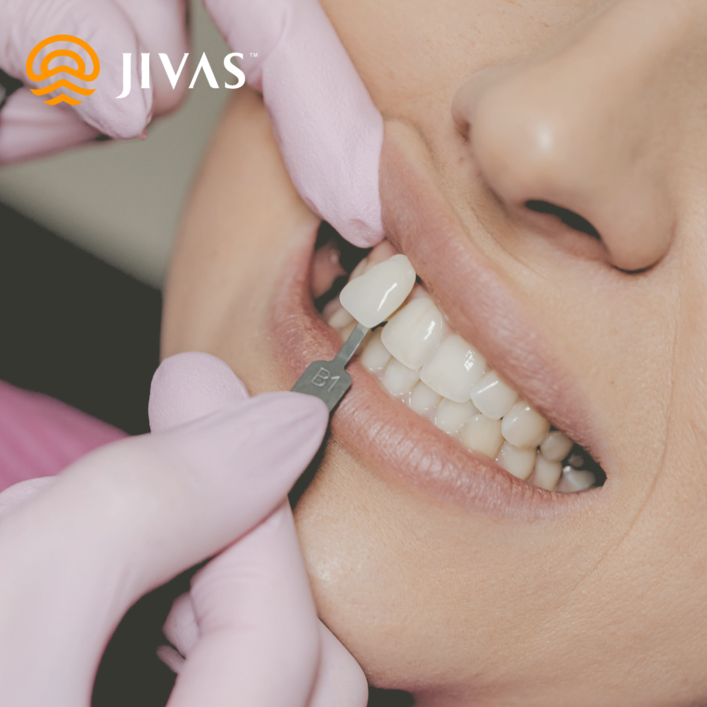 veneer dan bleaching
