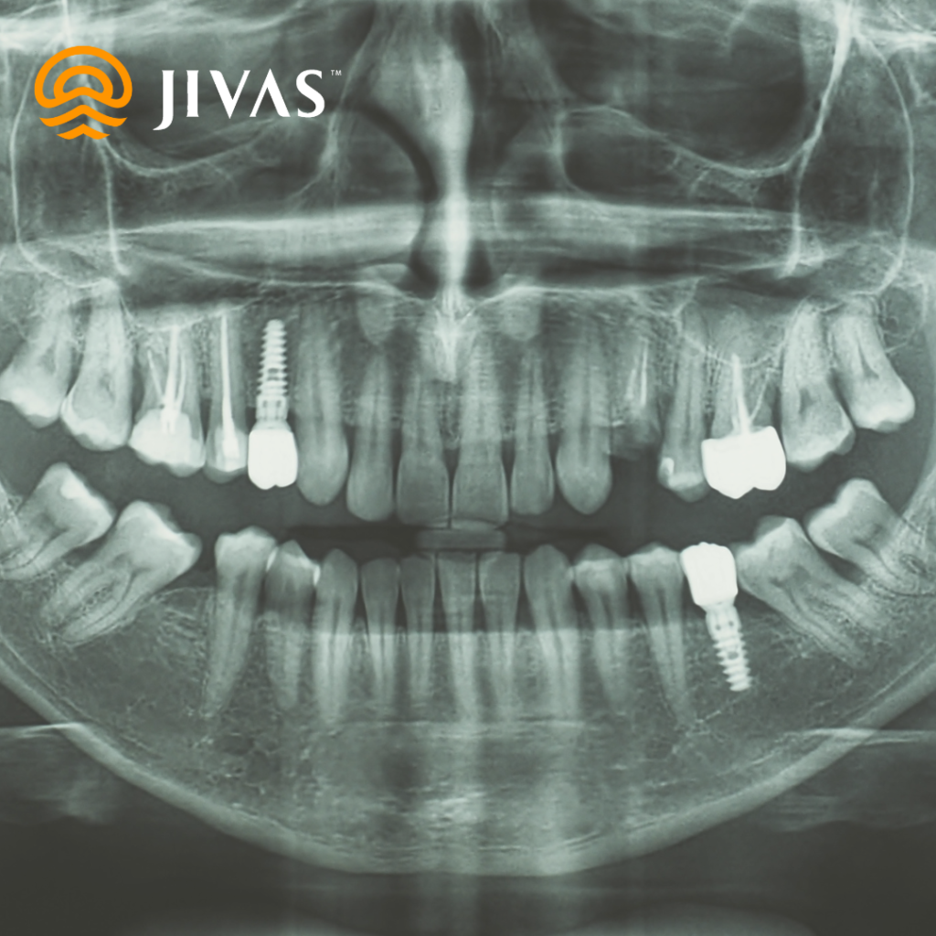 rontgen cbct