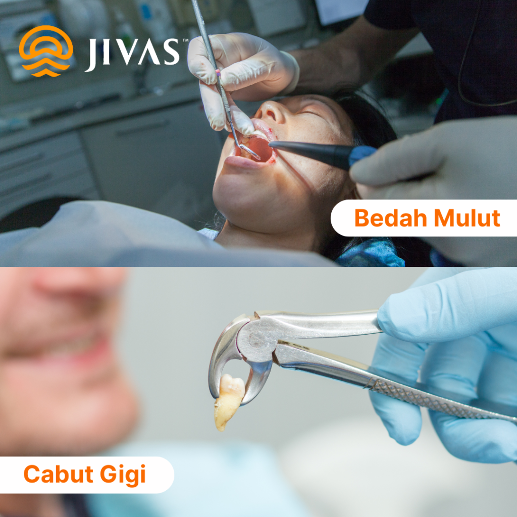 bedah mulut cabut gigi
